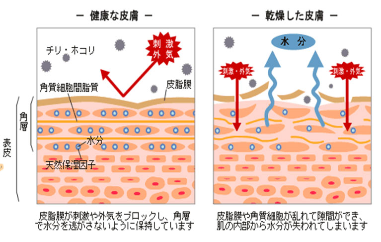 乾燥肌とは