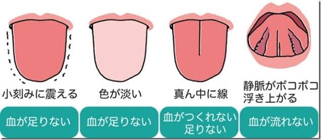 舌 でわかるその日の体調の見分け方 Andona 美容ブログ