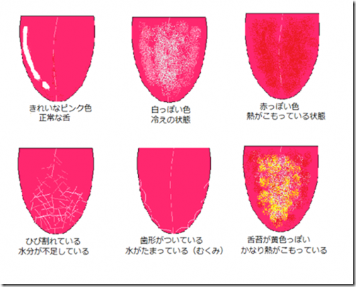 舌 でわかるその日の体調の見分け方 Andona 美容ブログ